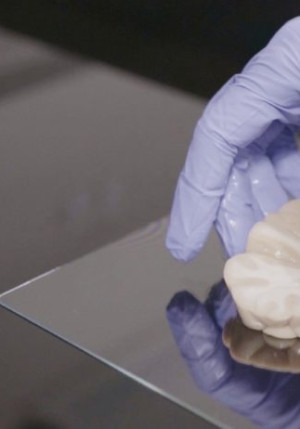 L'image montre une main qui porte un gant chirurgical violent et posant sur une plaque transparente une représentation en caoutchouc d'un cerveau.